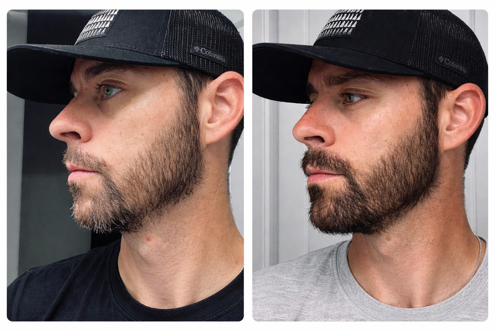 <p><strong>Why Thousands of Men Are Switching to Revive</strong></p>
