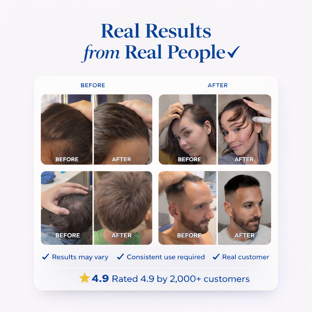 Revive Hair & Beard Growth Serum for Men
