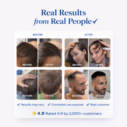 Revive Hair & Beard Growth Serum for Men