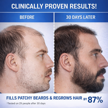 Revive Hair & Beard Growth Serum for Men