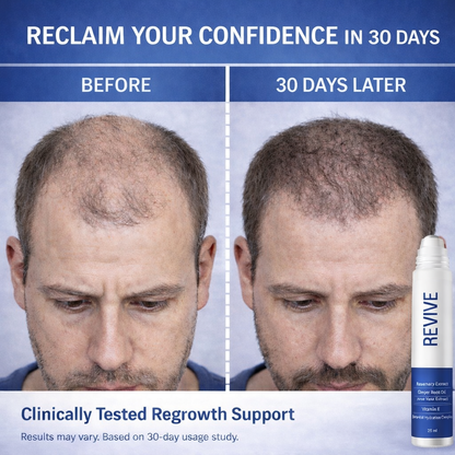 Revive™ Hairline Revival Serum