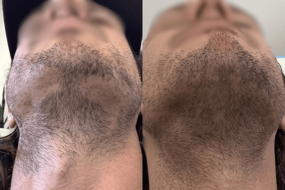 <p><strong>Why Thousands of Men Are Switching to Revive</strong></p>