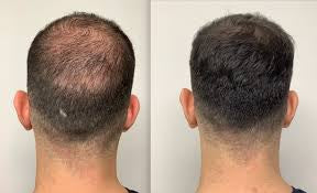 <p><strong>Why Thousands of Men Are Switching to Revive</strong></p>