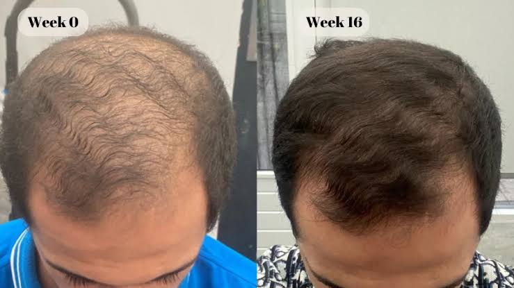 <p><strong>Why Thousands of Men Are Switching to Revive</strong></p>