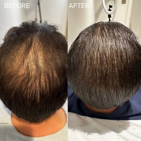 <p><strong>Why Thousands of Men Are Switching to Revive</strong></p>