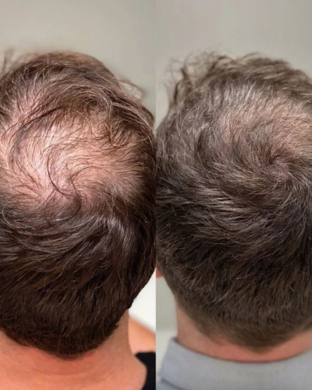 <p><strong>Why Thousands of Men Are Switching to Revive</strong></p>